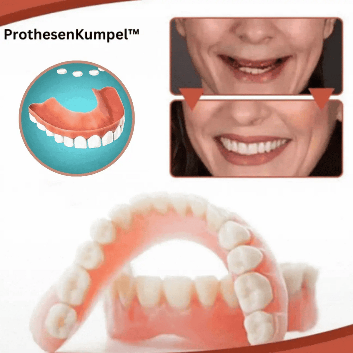Temporary Denture Kit Thermoformable Silicone Adjustable Fit